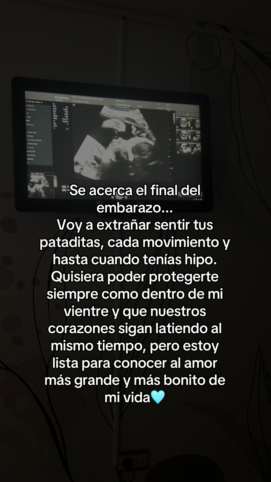@️camm
