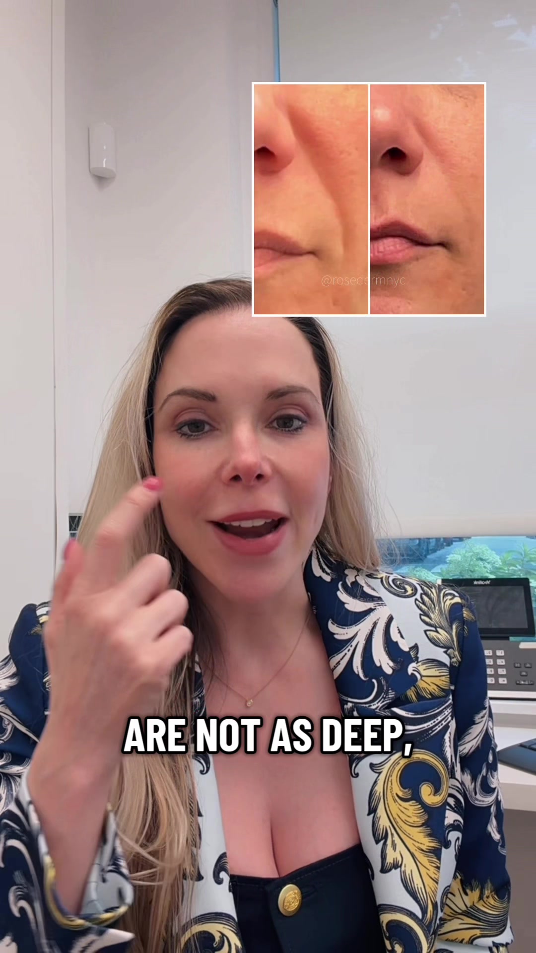 @Rosedermnyc