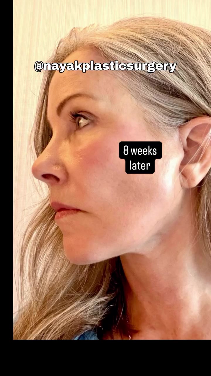 @NayakPlasticSurgery