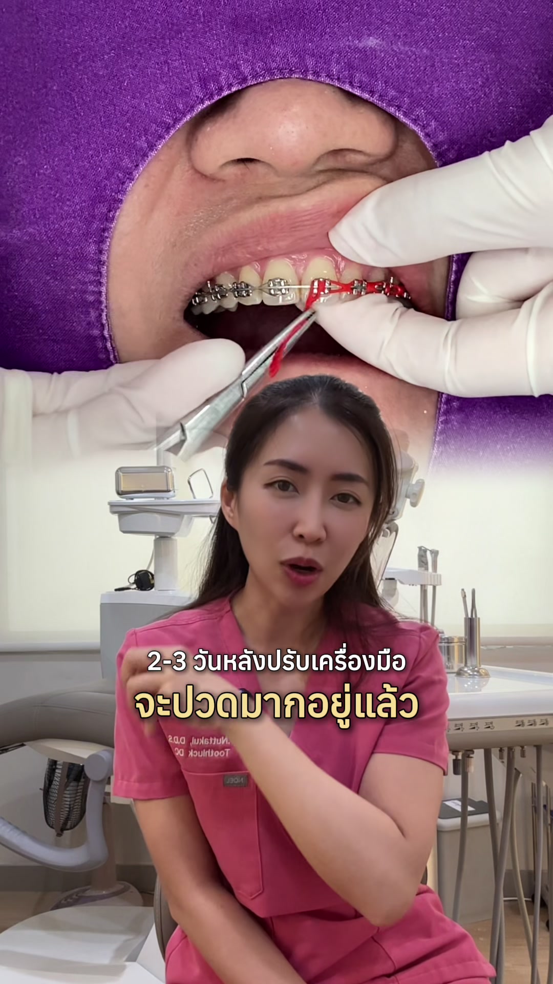 @ณัฐคุณ (Nuttakul Dent) 🦷