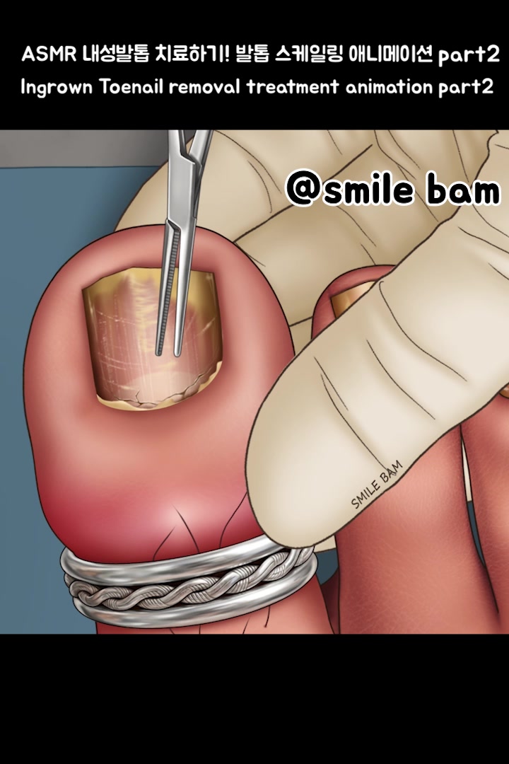 @Smile Bam