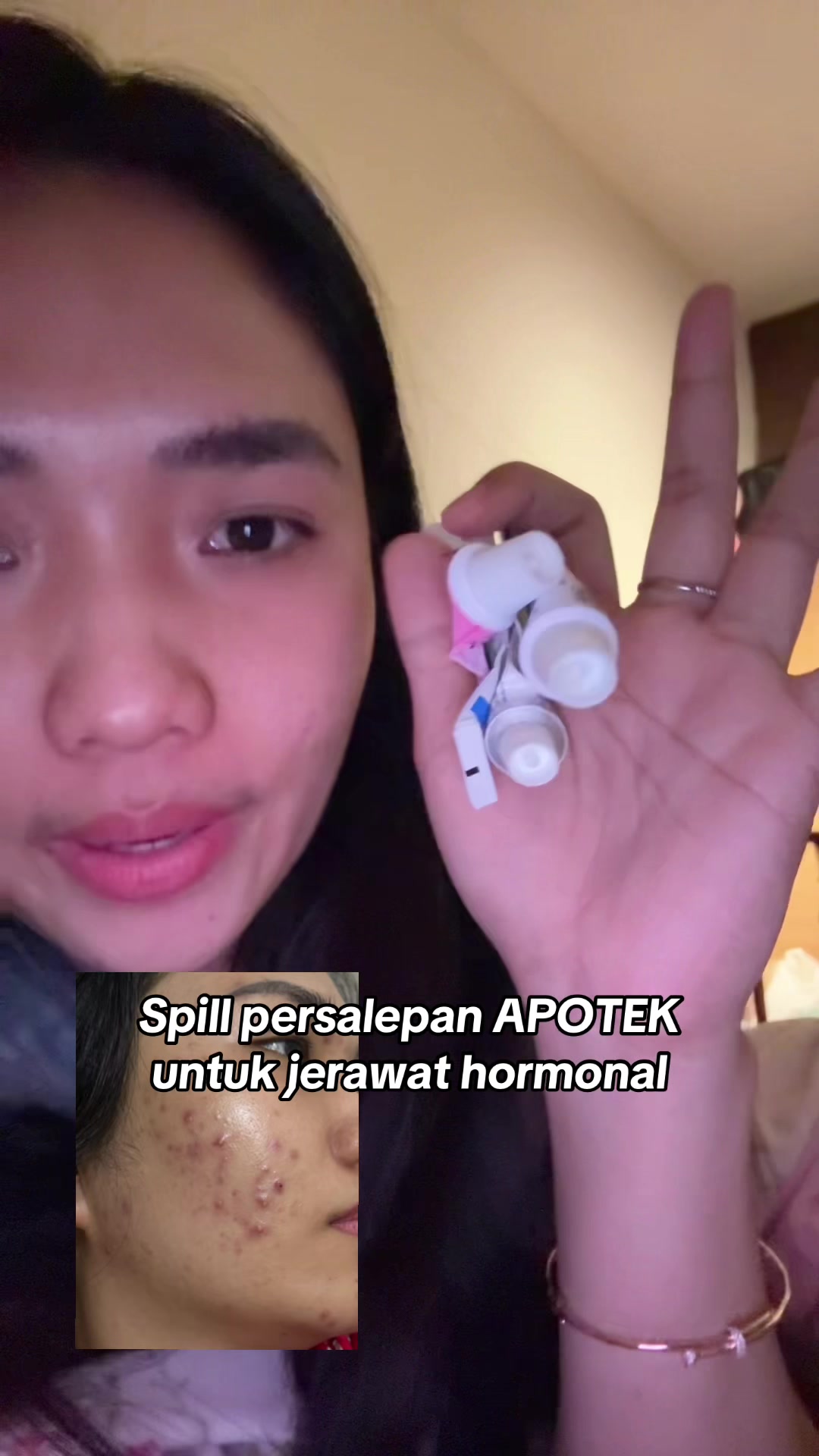 @Ciken🐣