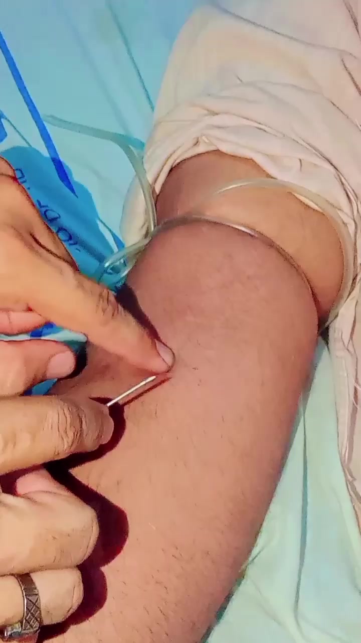 @جانی چٹھہ ــ کوٹلے ــ آلہ143✨✨