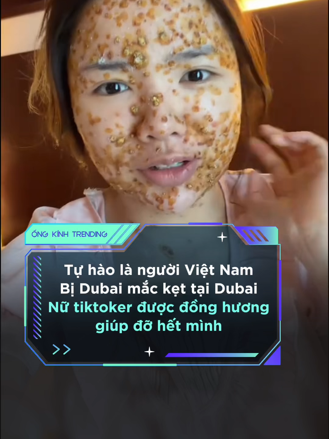 @ỐNG K&Iacute;NH TRENDING