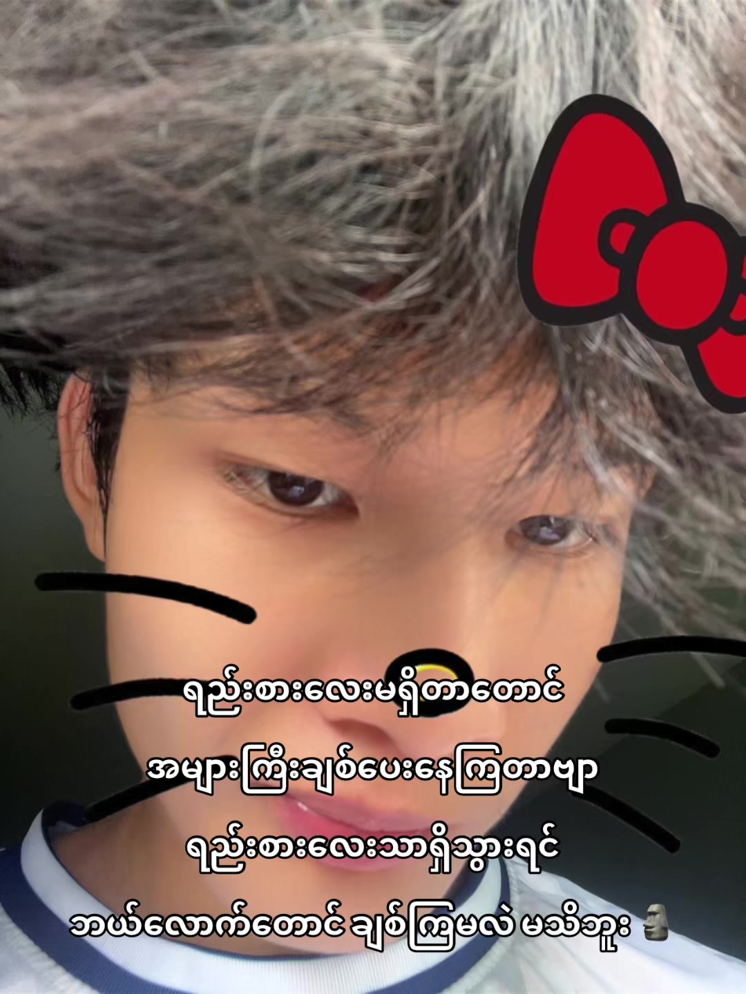 @Saw Aung