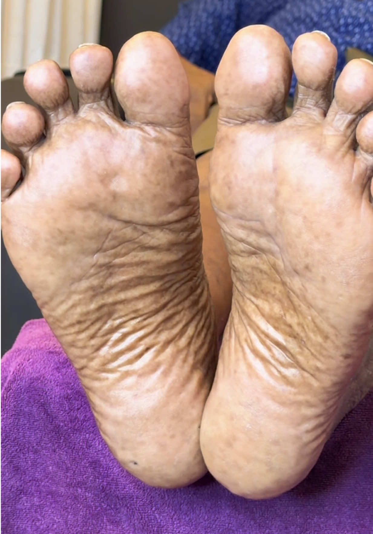 @LotusbeautyKlangSentosa