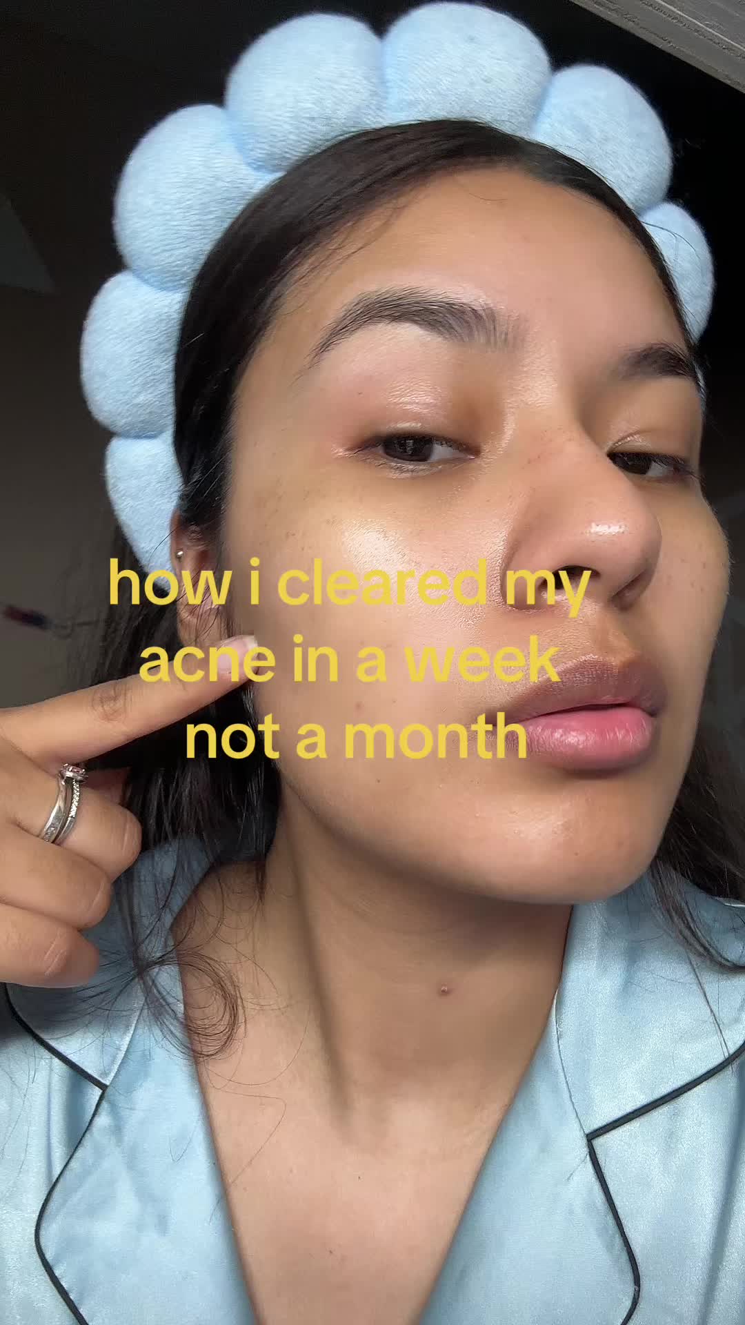 @Laura✨
