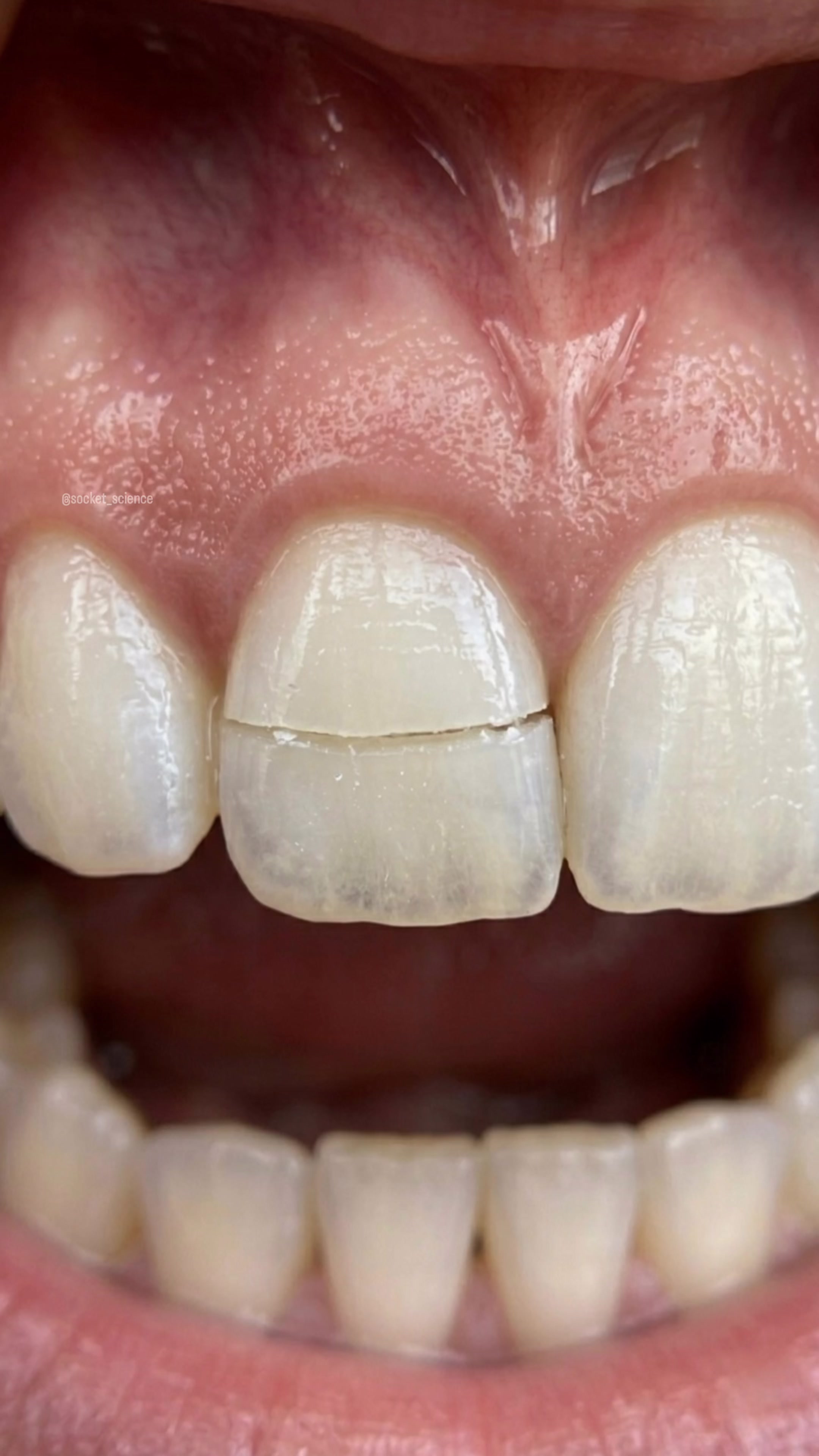 @Socket Science | Dental Visual