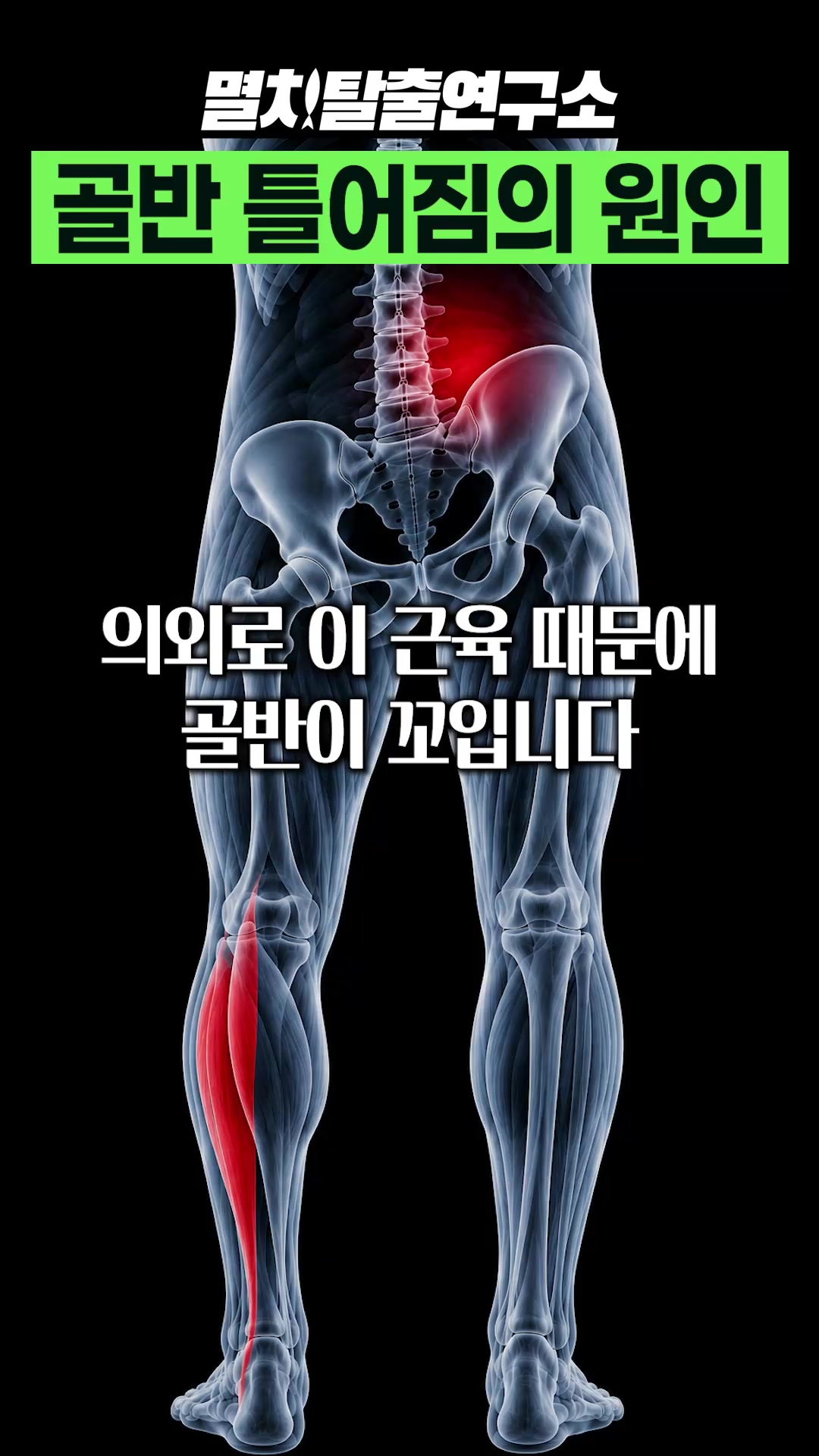@멸치탈출연구소
