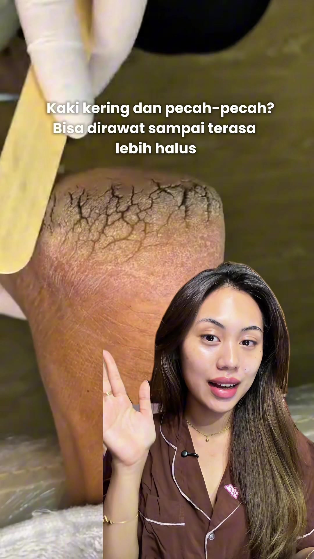 @dindapradnya