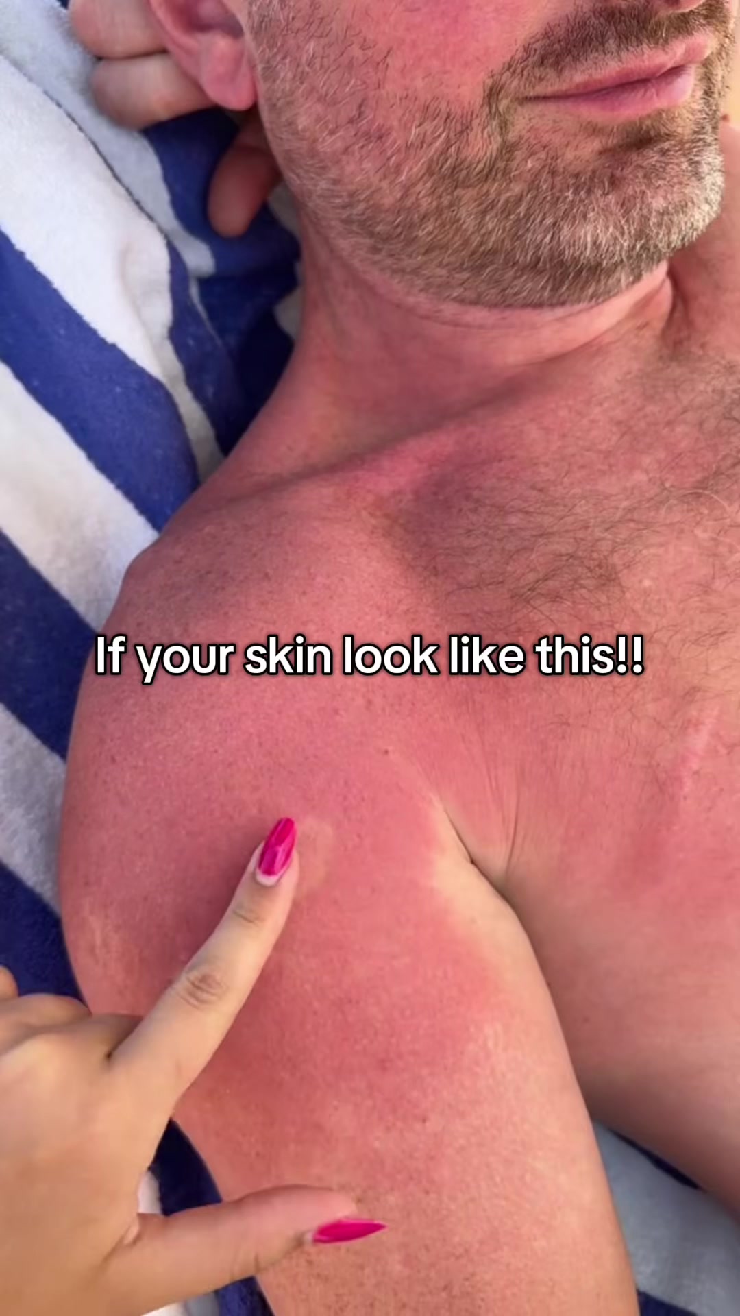 @sunsnap33