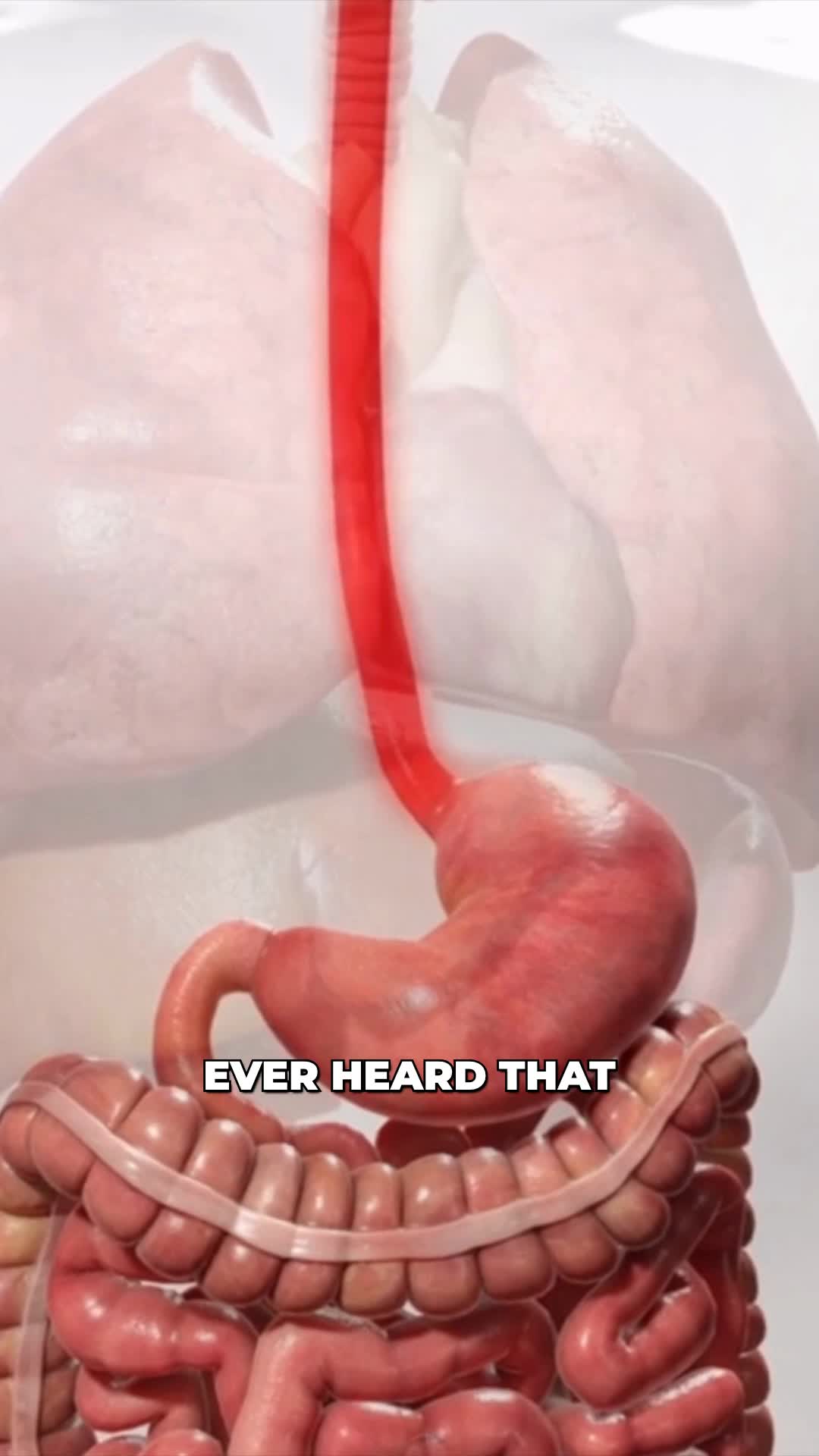 @Viz Medical
