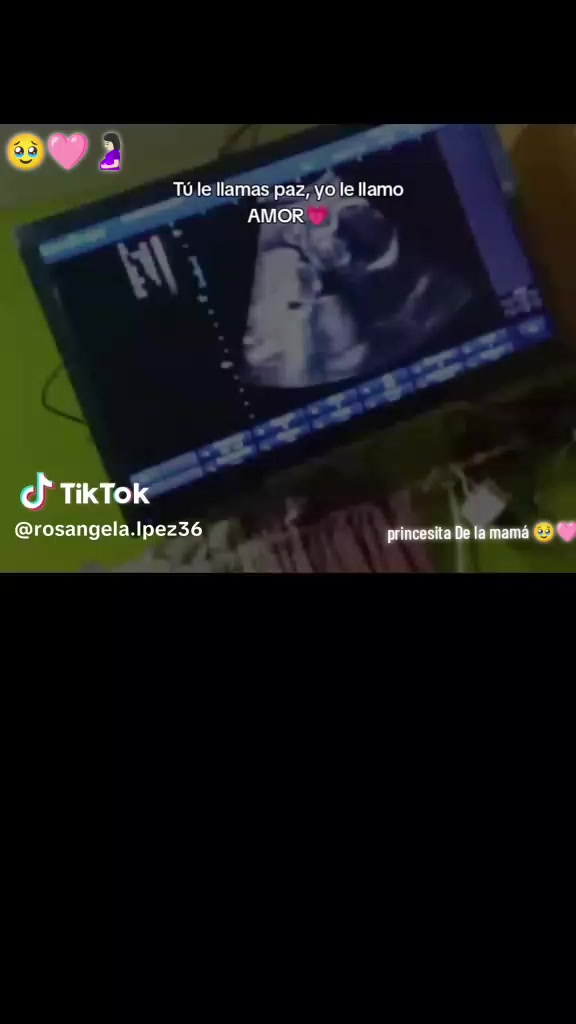 @Ale 🥹🖤!
