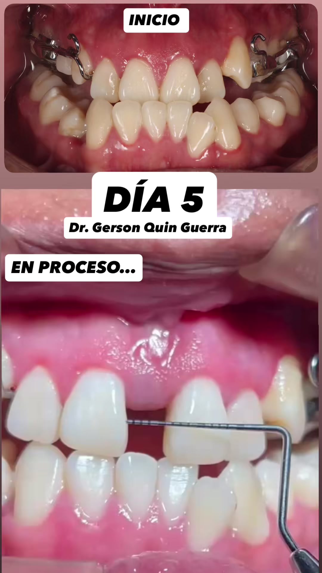 @Dr. Gerson Quin Guerra, PhD