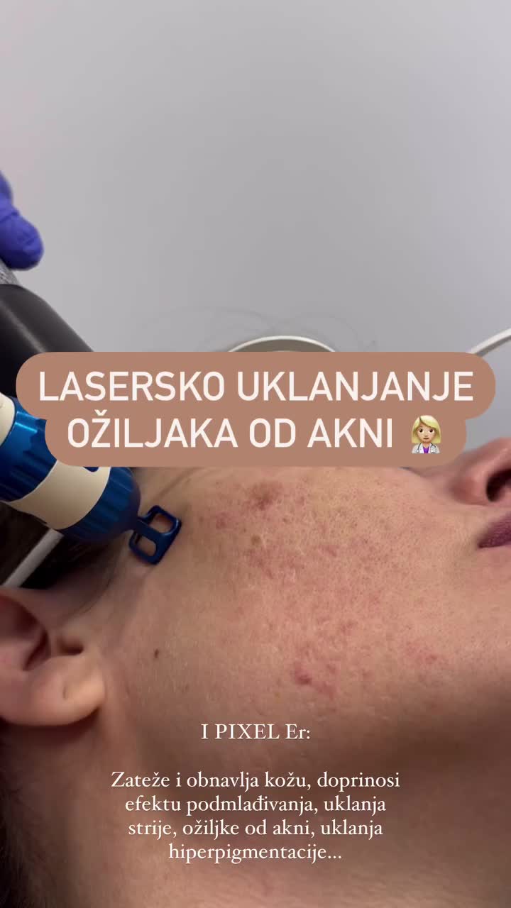 @DivaLaserCentar