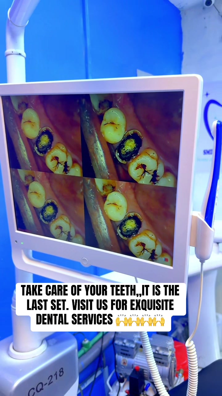 @THE SMILEY DENTAL KE