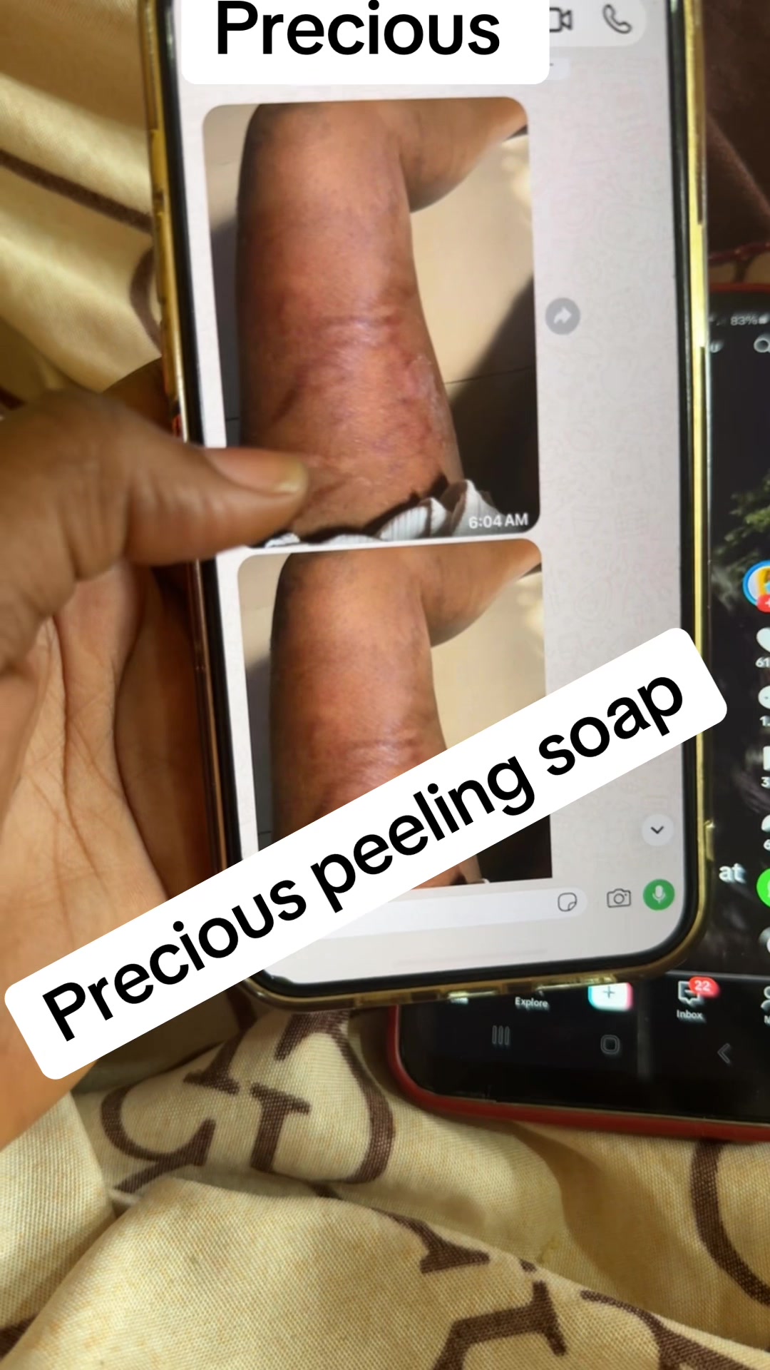 @@ Precious peeling soap