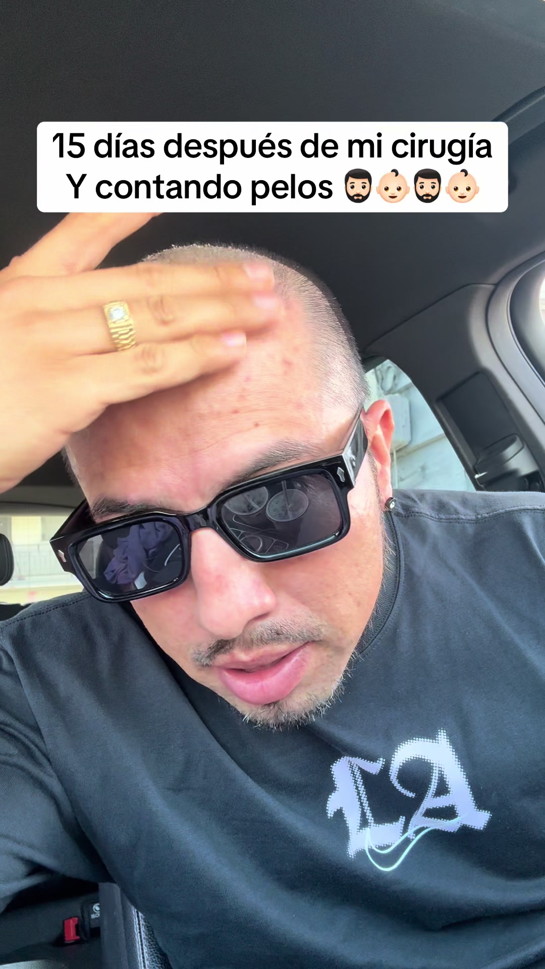 @Jhon😎🇨🇴🇺🇸 El Monacho