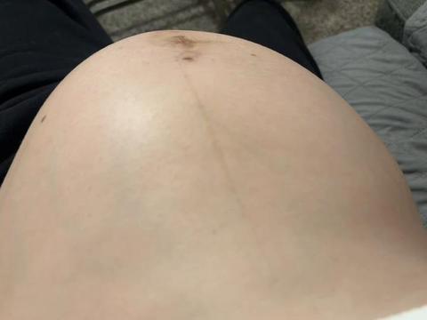 @The baby