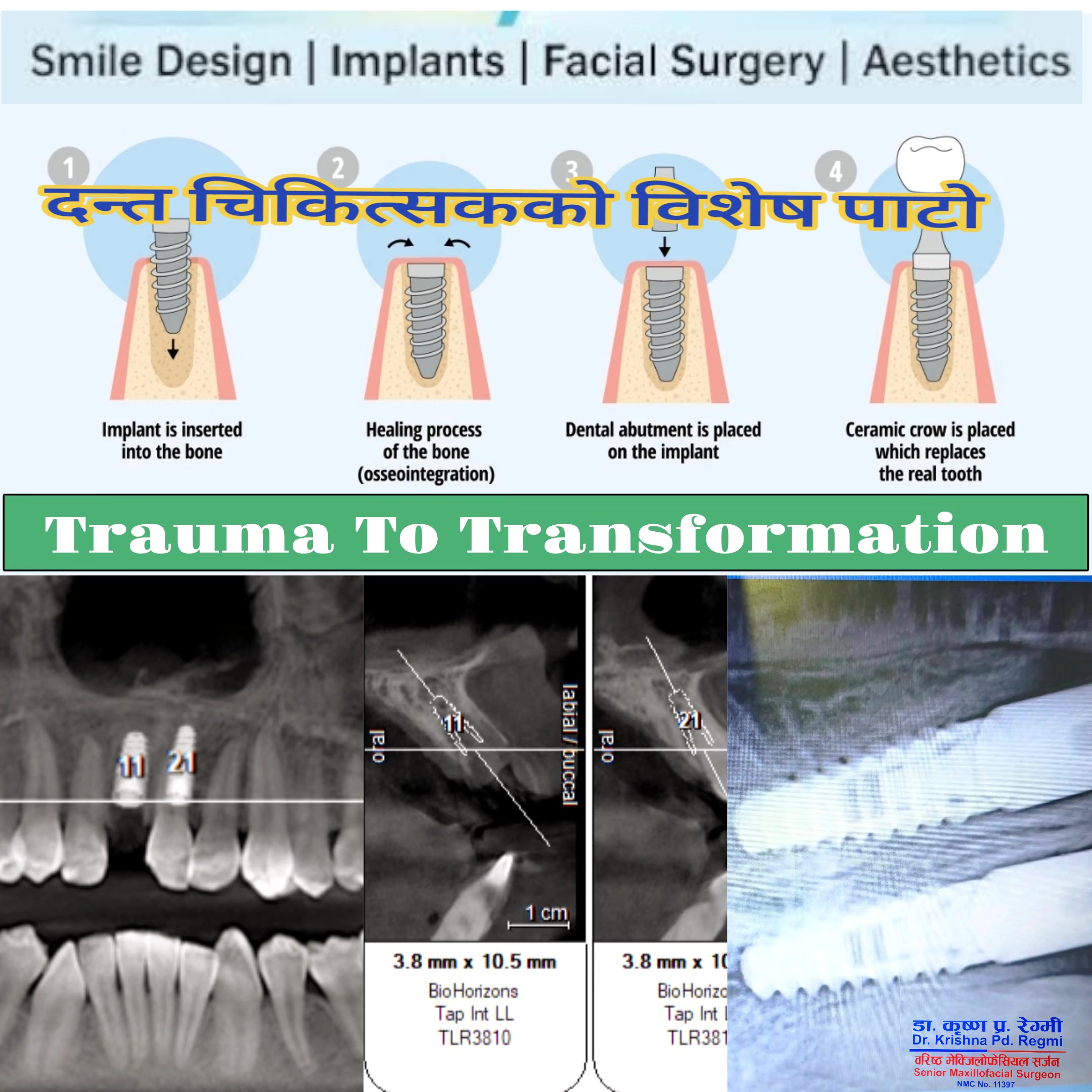 @Dr. Krishna Regmi