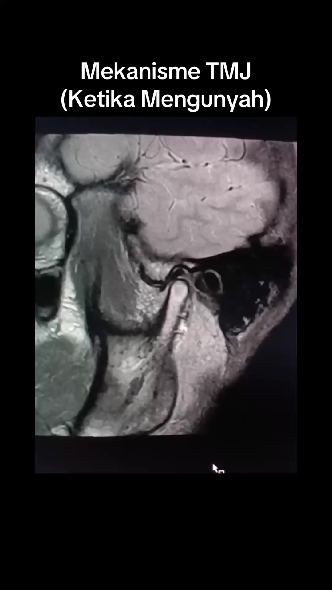 @Sobat Radiology