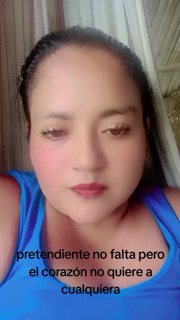@🦄 ♥ merxy M C A👸