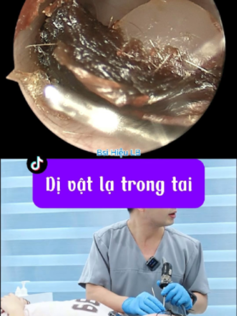 @Bs Hiệu Tai Mũi Họng Long Bi&ecirc;n