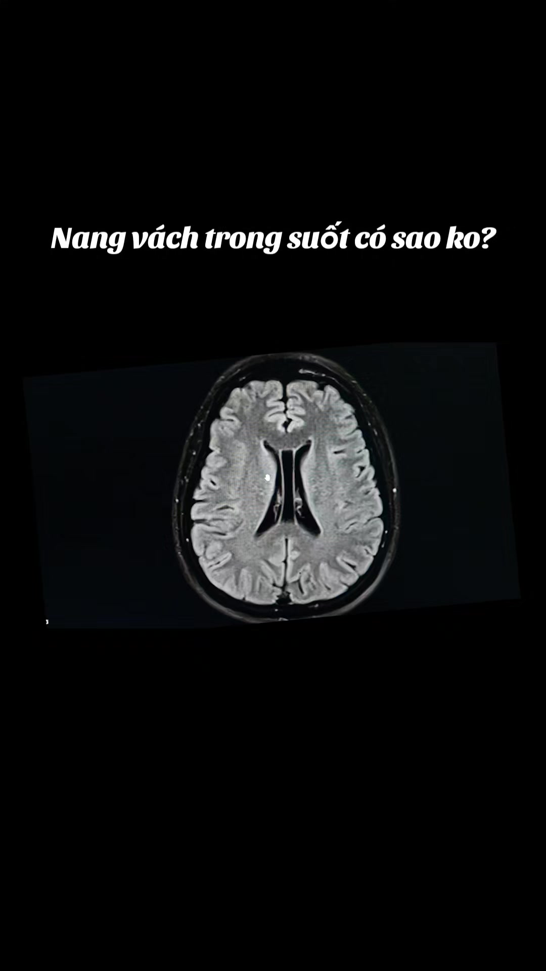 @Nguyễn Văn T&ugrave;ng