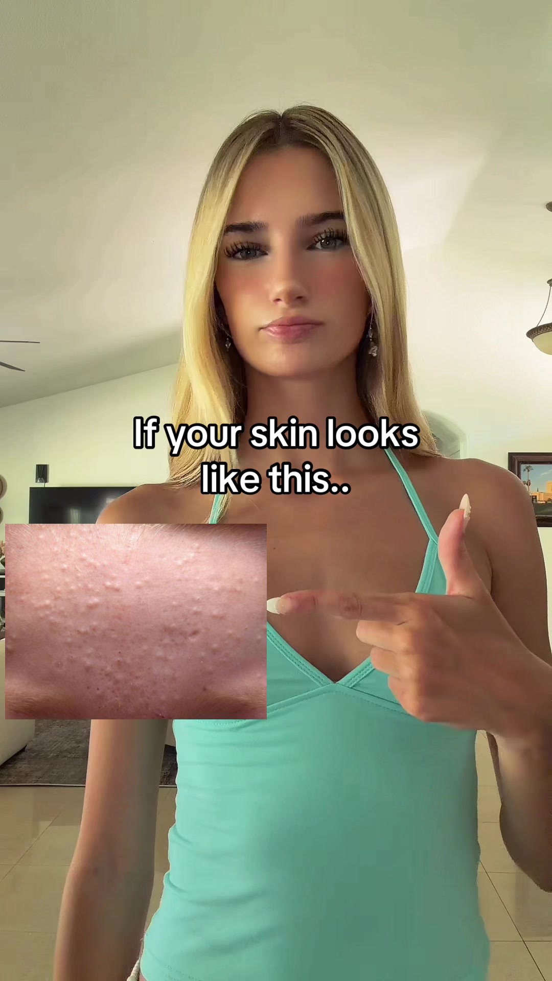 @trueemmy