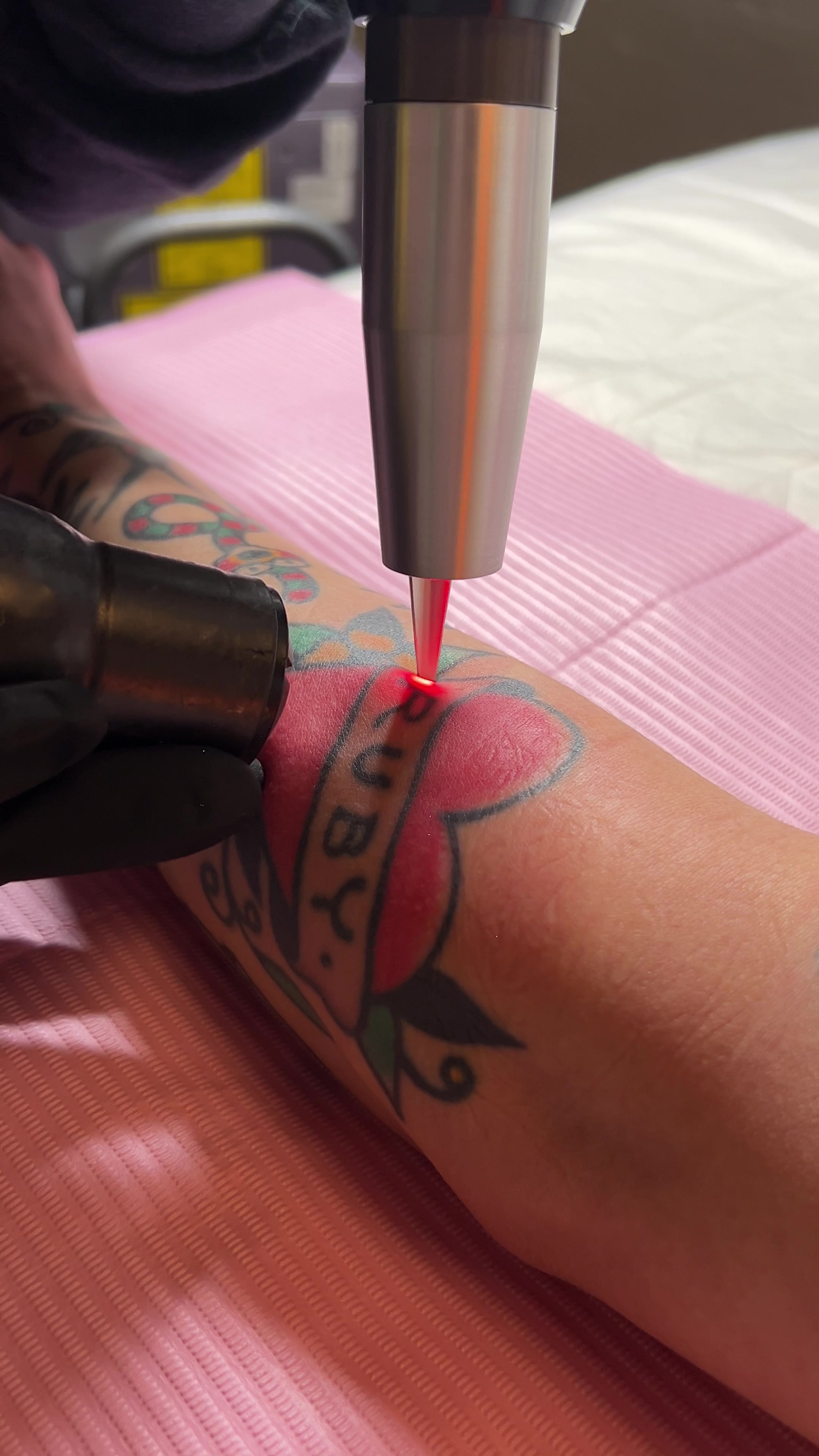 @Swift_tattoo_removal