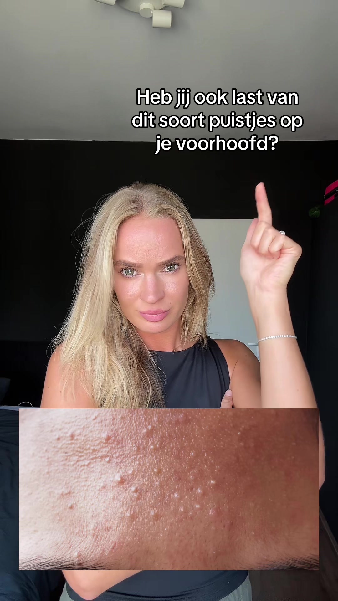 @Skinfixer