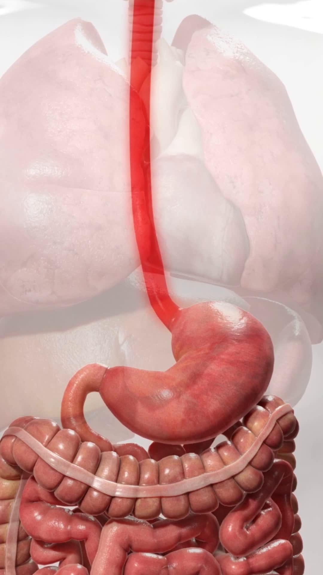 @Viz Medical