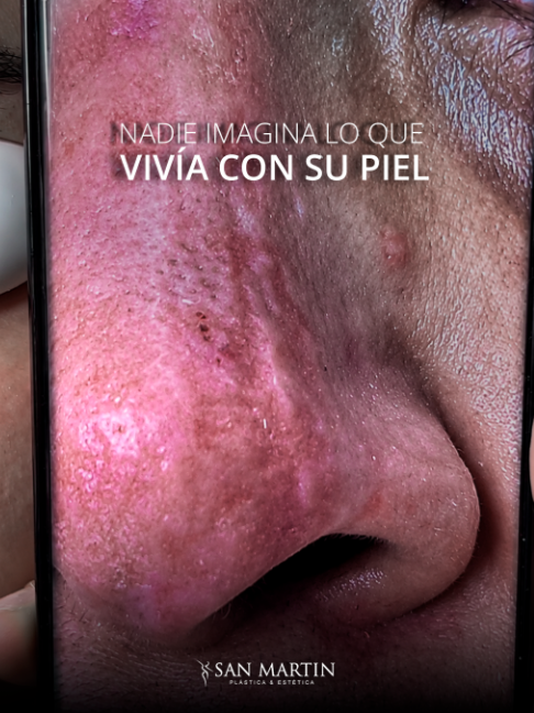 @Clínica San Martín
