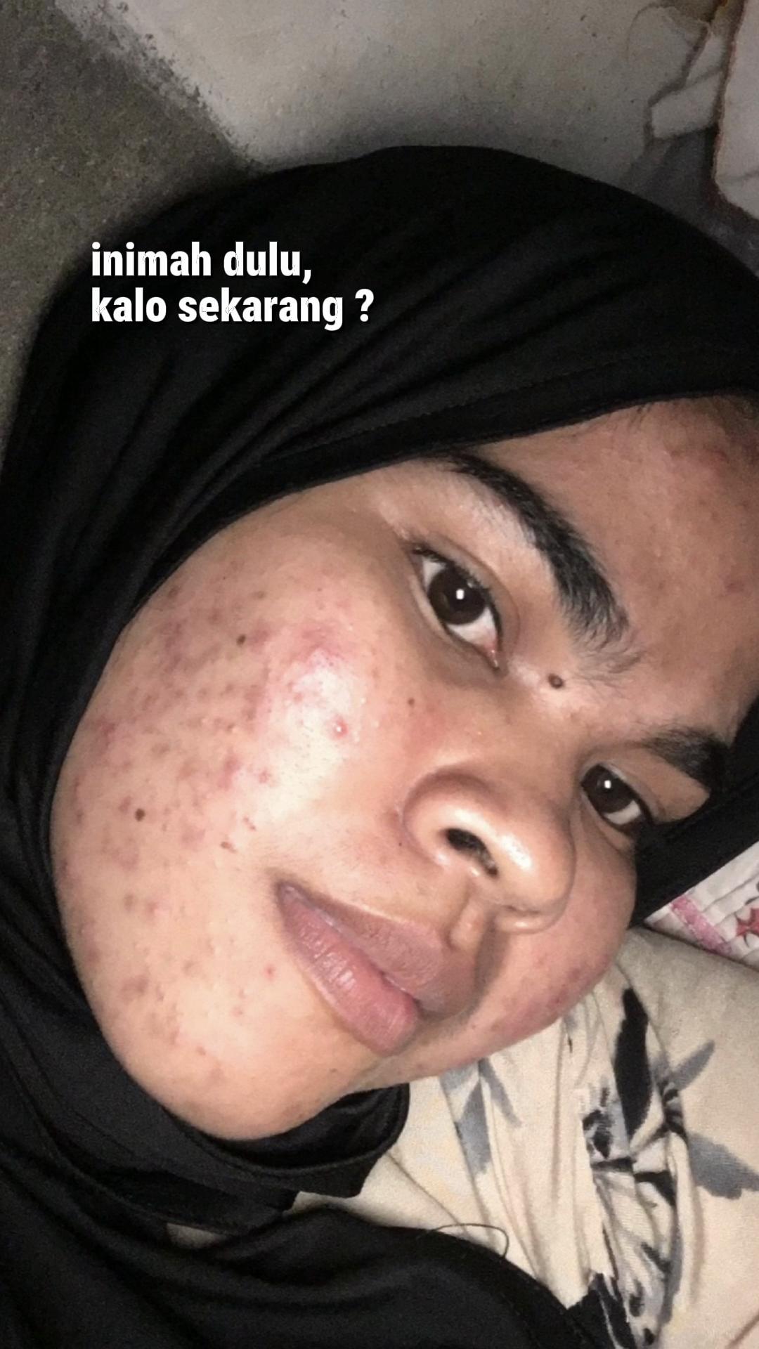 @TREND&SKIN