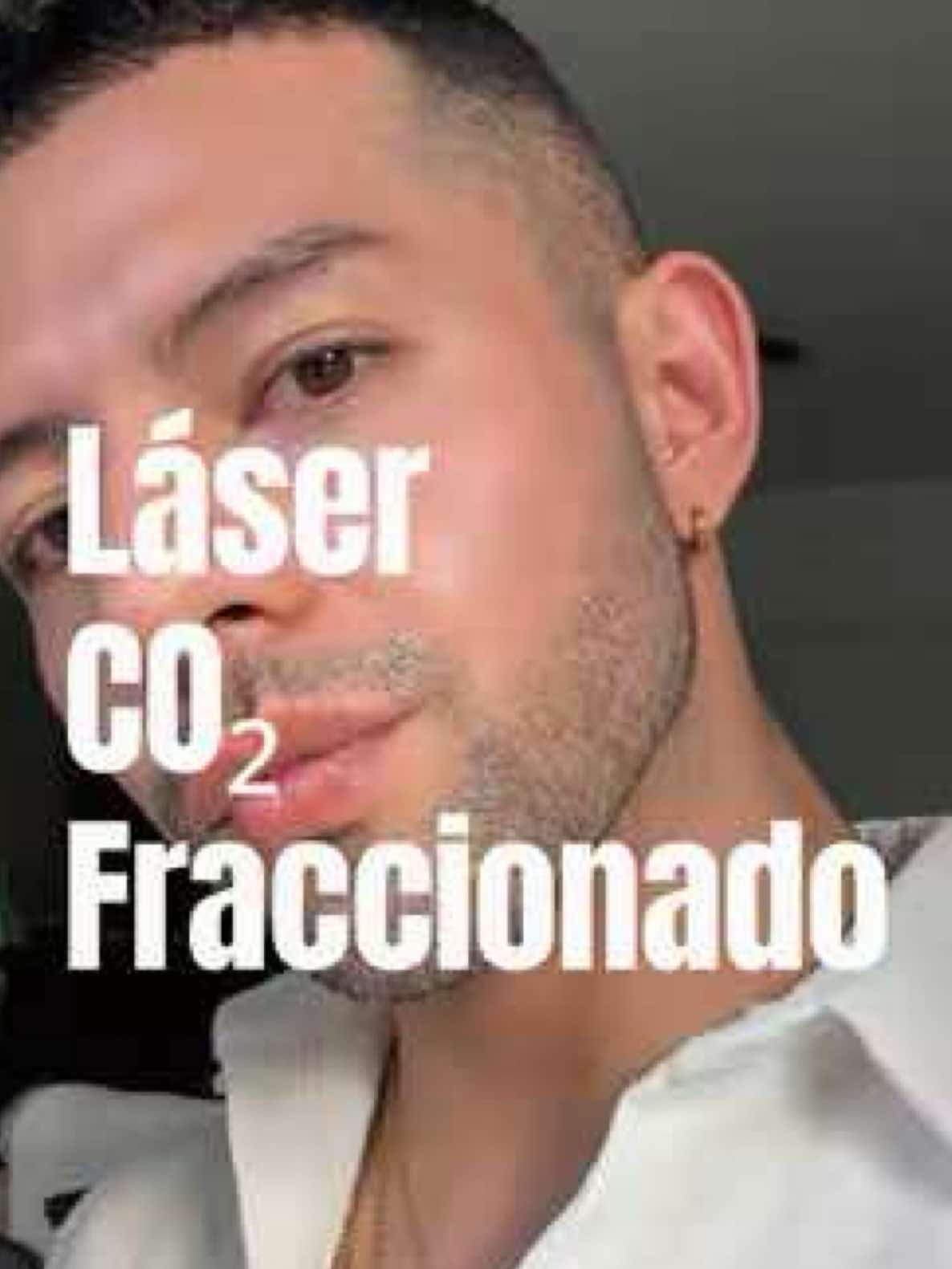@Omgluisfer