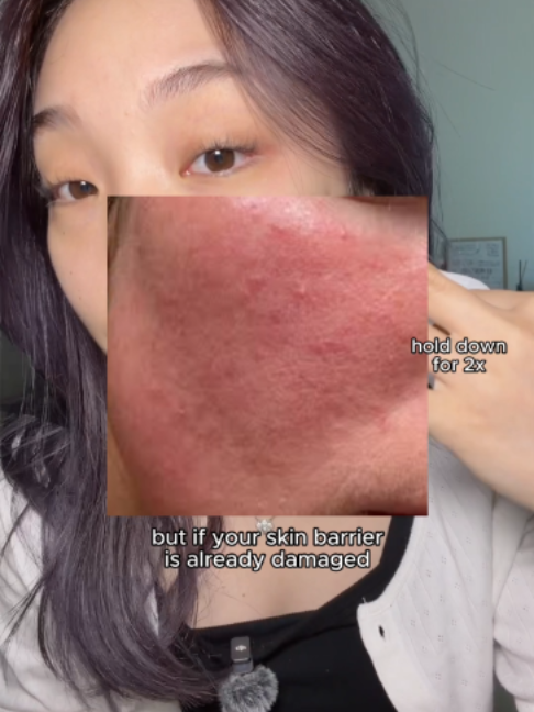 @lily
