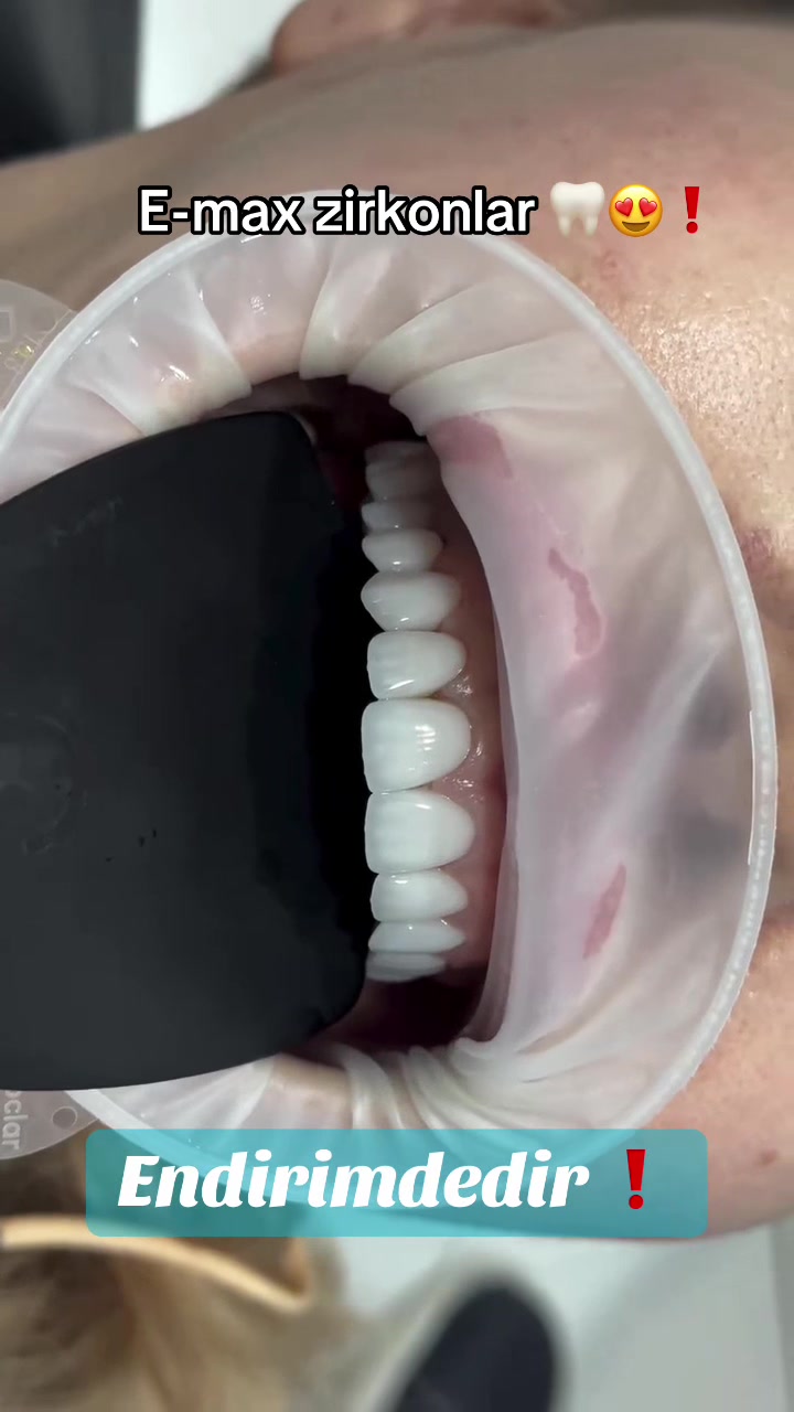 @𝐁𝐚𝐲𝐃𝐞𝐧𝐭𝐄𝐥𝐢𝐭𝐞🦷