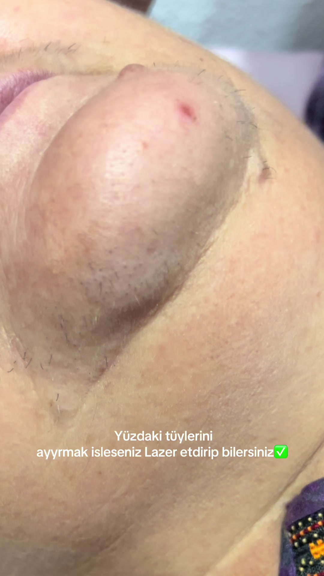 @guljana_laser_beautysalon