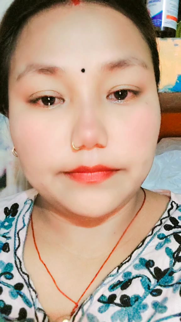 @Bimala sunarni❤️&zwj;🩹💫