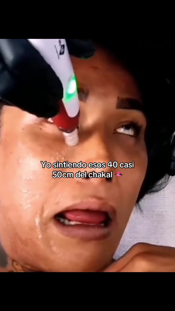 @Alan Jhoel