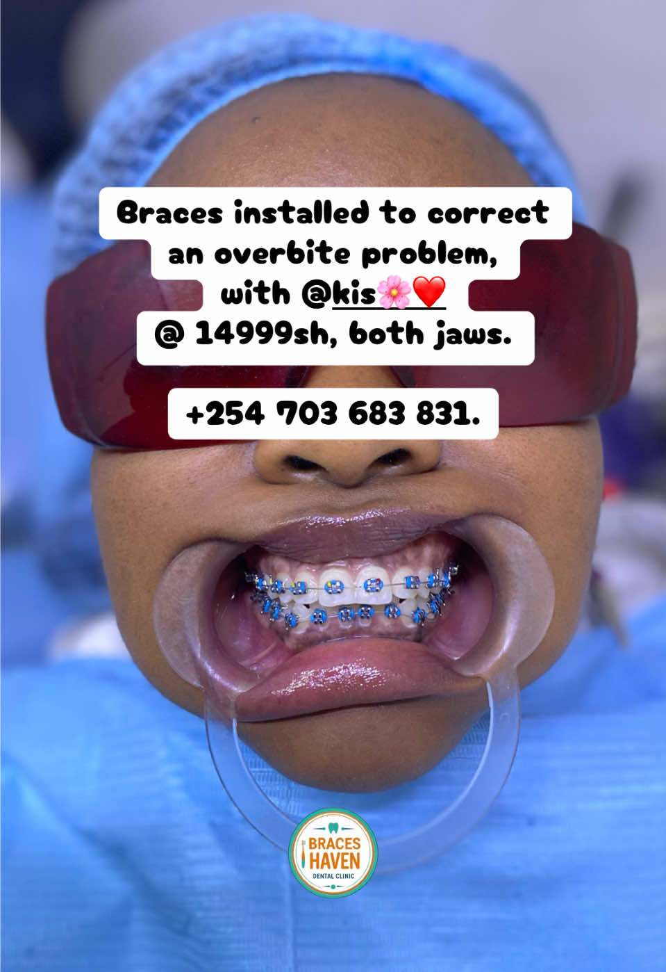 @Braces Haven Nairobi Dental