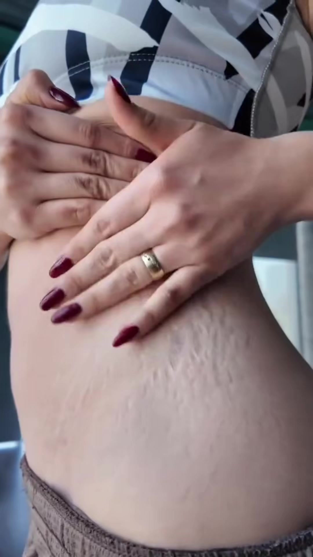@Dermat&oacute;loga Cindy Burbano
