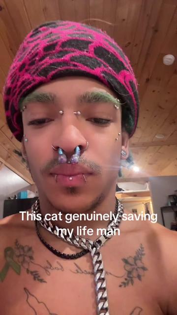 @Alt prince 🧑🏽🦽➡️