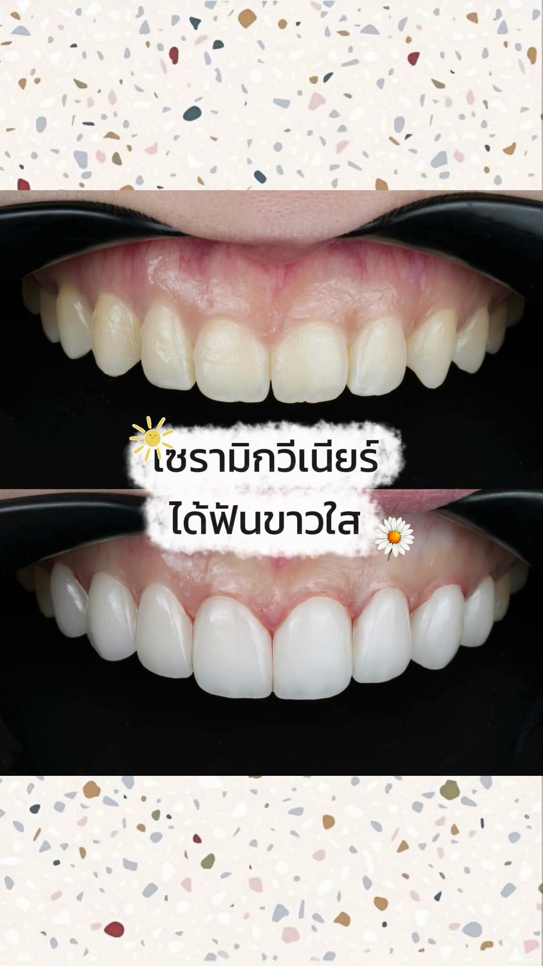 @smile Art Pattaya
