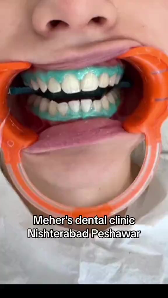 @dr_meher_official