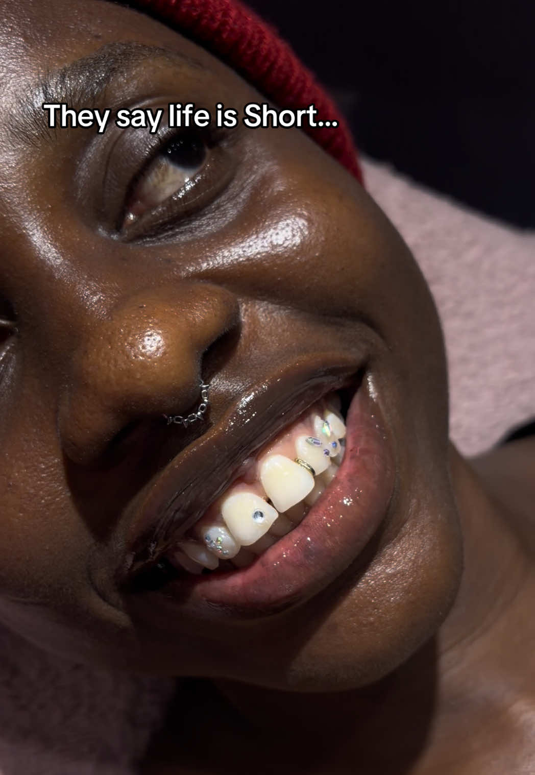 @Abuja Fashion Braces/Toothgems
