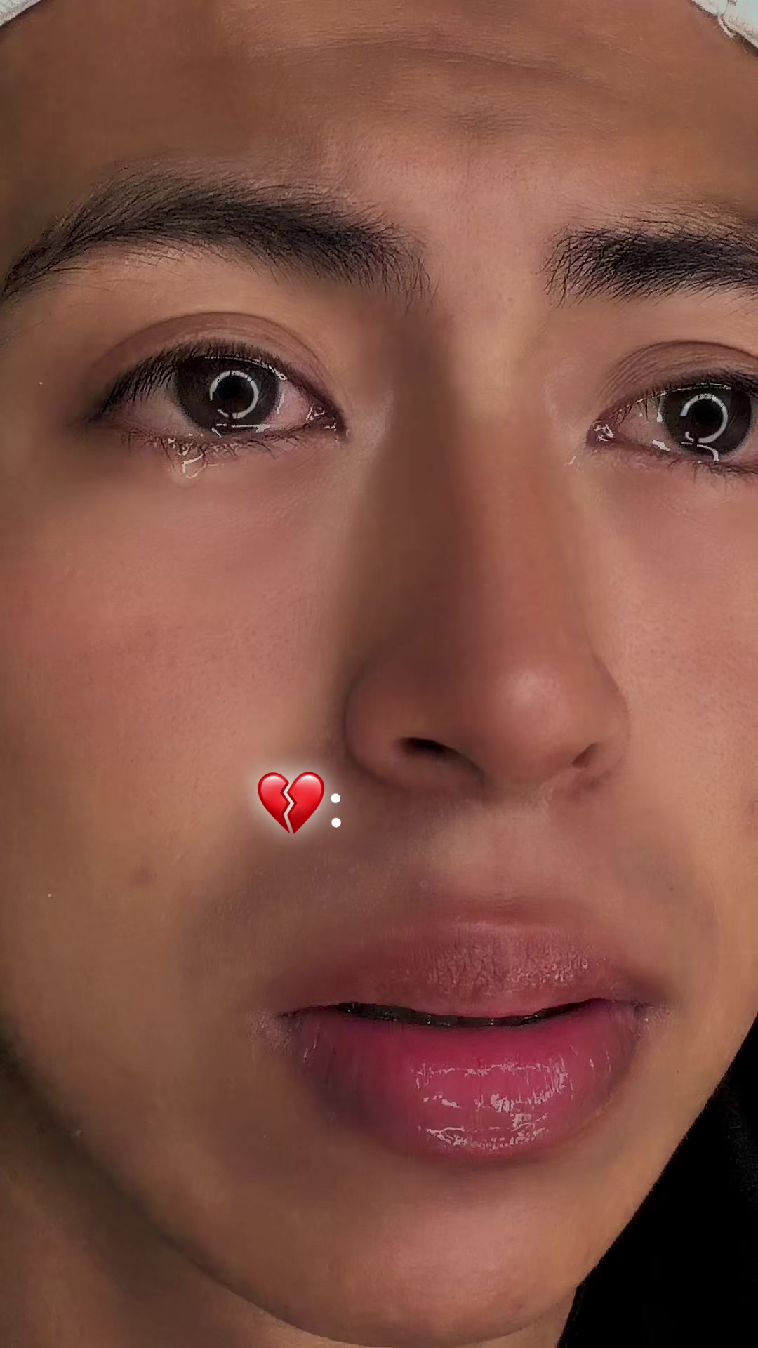 @Fernando🎗️