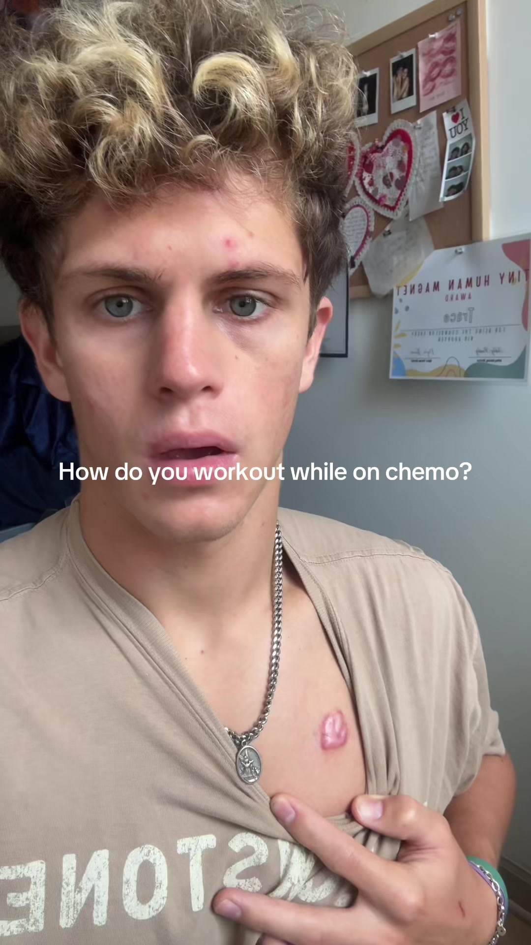 @Trace🎗️