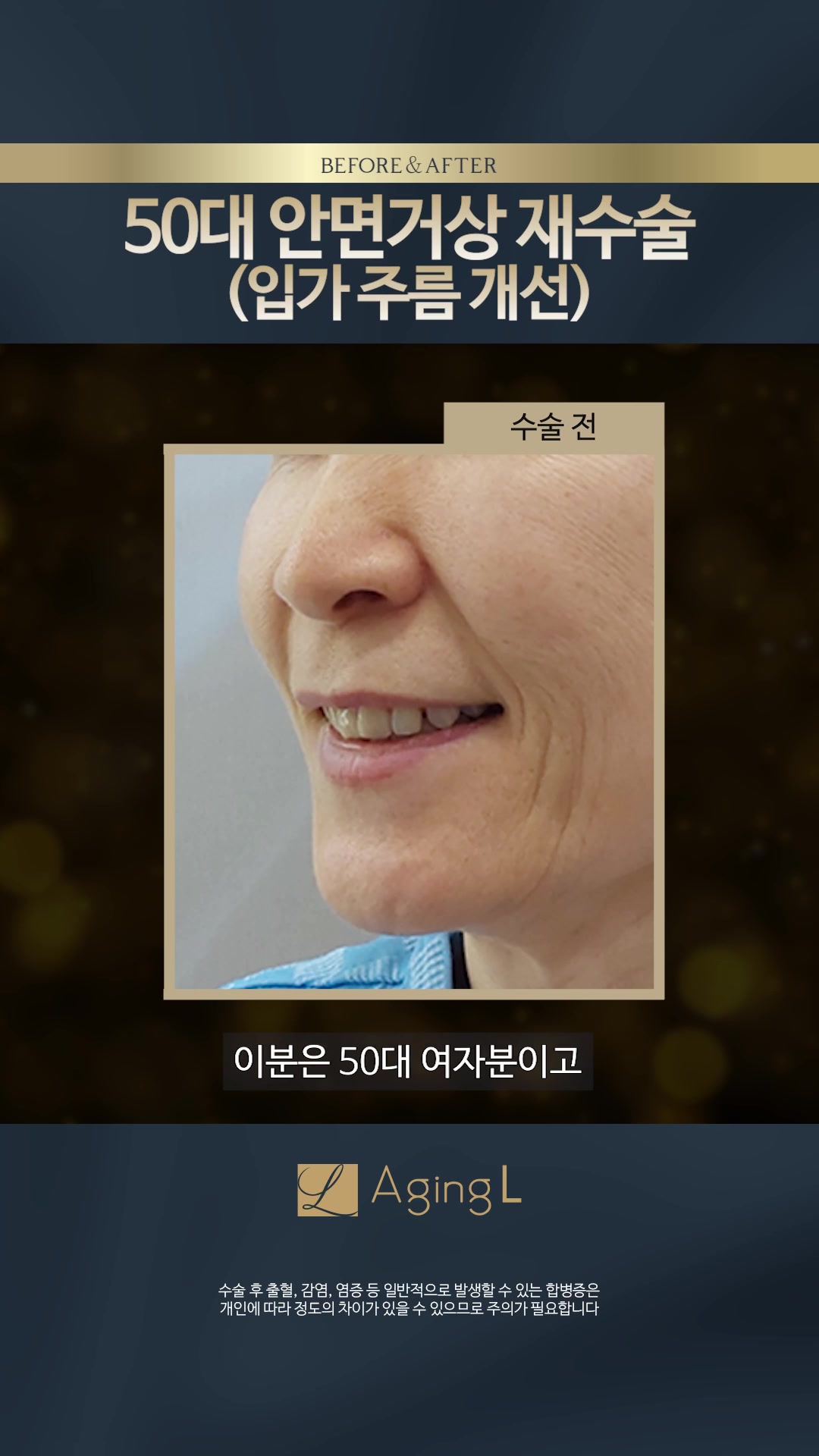 @agingl_official