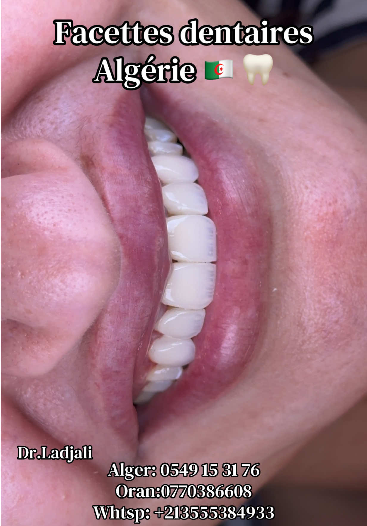 @Dr.ladjali